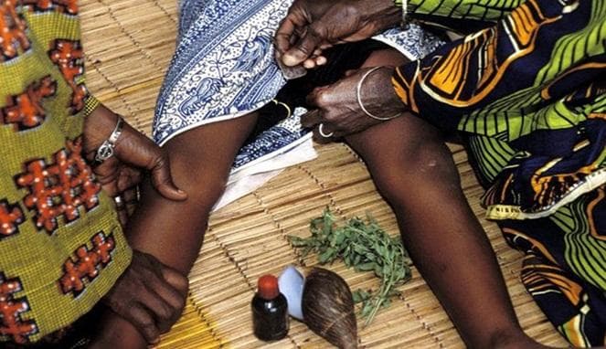 Ilustrasi sunat. (Reqnews.com)