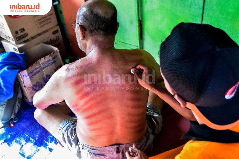 Kerokan di tengah-tengah tugas. (Inibaru.id/ Audrian F)<br>