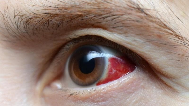 Perempuan India mengeluarkan darah saat menstruasi. (iStockphoto)<br>