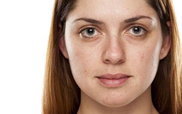 Kulit tampak pucattanpa jerawat. (iStockphoto)