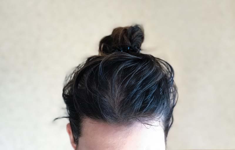 Rambut berminyak. (iStockphoto)