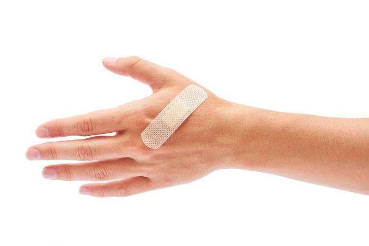 Ilustrasi luka. (Thinkstock via Kompas)