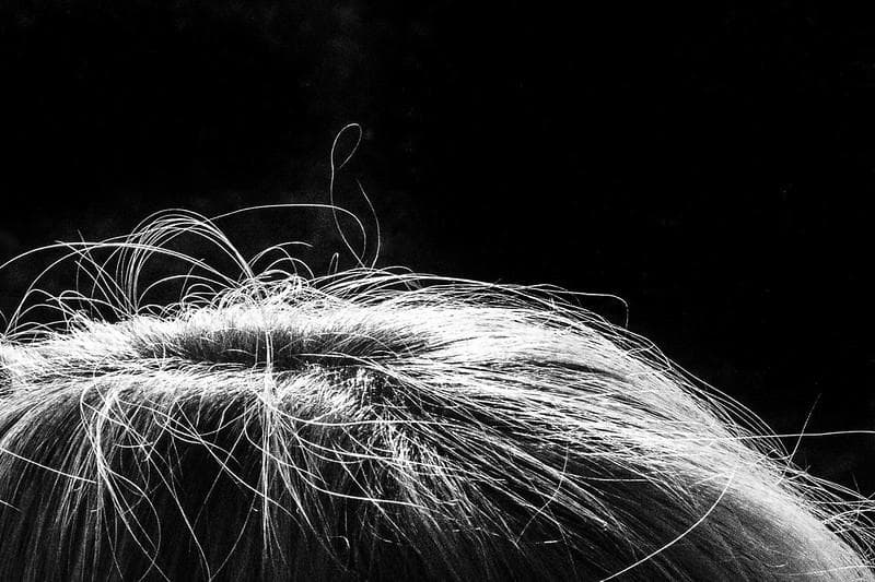 Uban di usia muda, murni karena stres? (Flickr/

Patrik Nygren)