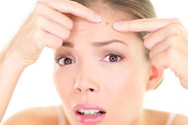 Serum dengan salicylic acid untuk kulit berjerawat. (Shutterstock via Gatra)