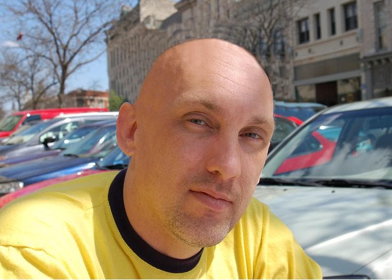 Orang botak tetap harus menjaga kulit kepala. (Flickr/

Scott Feldstein)