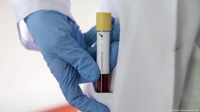 Pemilik golongan darah A disebut-sebut lebih rentan terinfeksi virus corona. (picture alliance/AA/A. Unal)