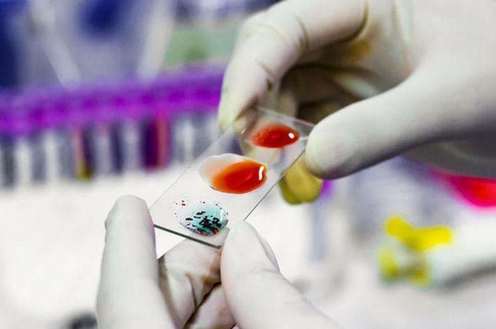 Pemilik golongan darah tertentu lebih rentan terinfeksi virus corona. (Shutterstock)