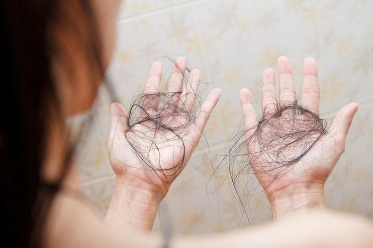 pori-pori kulit kepala bisa terbuka sehingga rambut dapat rontok dengan mudah. (Shutterstock/Nalada N via Kompas)