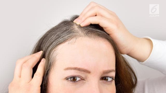 Uban bakal tumbuh kembali meski sudah kamu cabut. (iStockphoto via Liputan6)