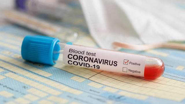 <i>Rapid test</i> nggak akurat dan efektif mendeteksi virus corona. (Shutterstock)