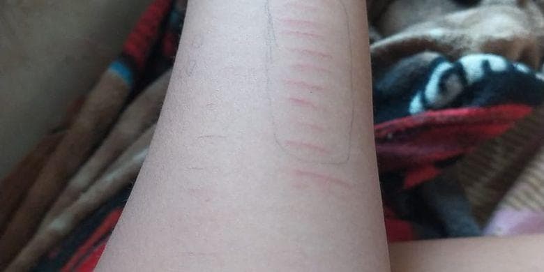 Waspada, Konten "Self Harm" di TikTok Banyak Meracuni Anak-Anak