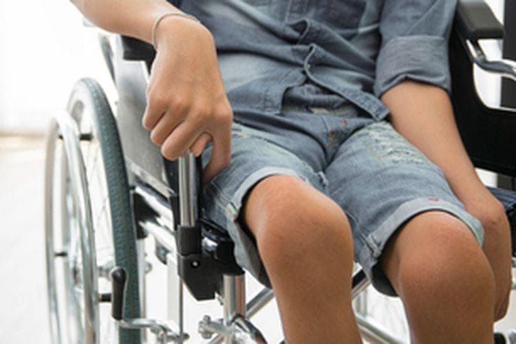 Virus polio dapat mengakibatkan penderita mengalami kelumpuhan. (Shutterstock)