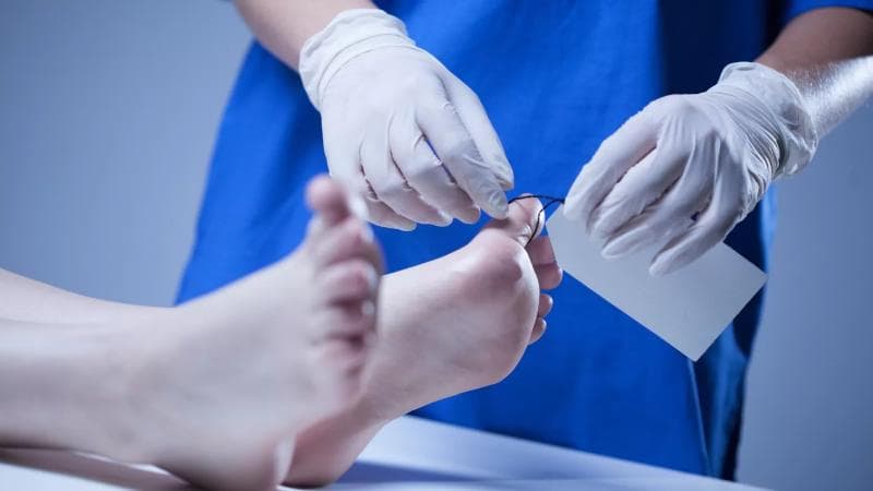 Femisida Intim, Sebuah Sisi Gelap Budaya Patriarki