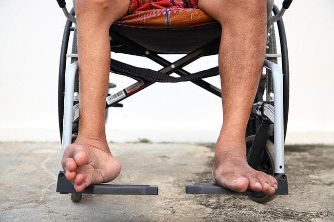 Jangan sampai polio menghambat generasi penerus menggapai cita-cita. (Alomedika)