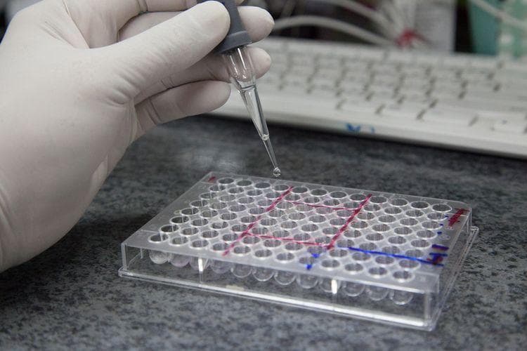 Peralatan rapid test. (Shutterstock)<br>