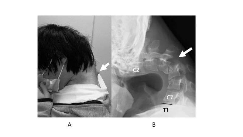 Main Gim di Ponsel hingga Lupa Waktu, Kepala Laki-laki Ini Terus Menunduk