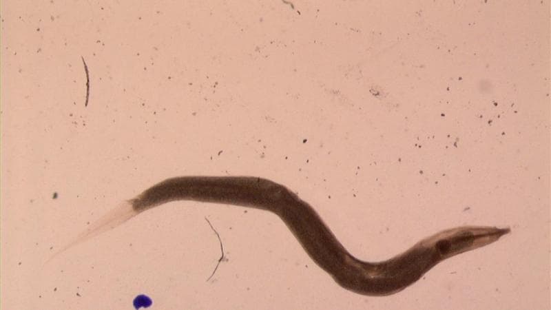 Cacing Kremi: Penyakit Sepele yang Mengintai Anak dan Cara Efektif Mencegahnya