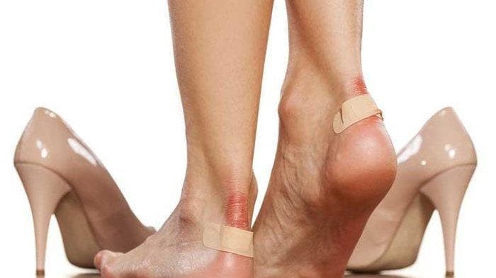 Lekatkan plester jika iritasi. (Sehatly)<br>