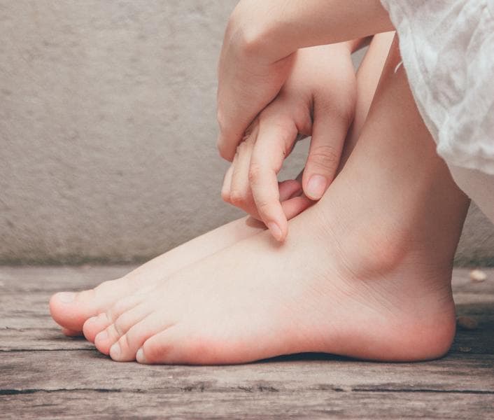 Mengatasi tumit pecah-pecah dengan cara yang tepat. (Pexels)<br>