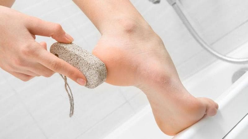 Lakukan eksfoliasi untuk perawatan tumitmu agar nggak pecah-pecah. (Medkomtek)