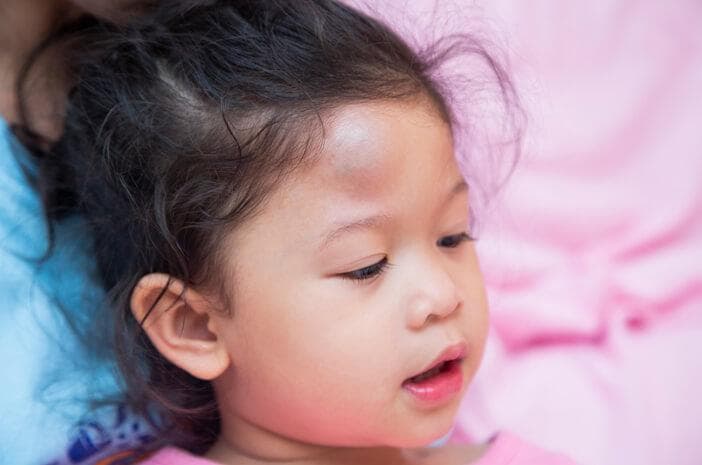 Benjol di kepala. (Halodoc)