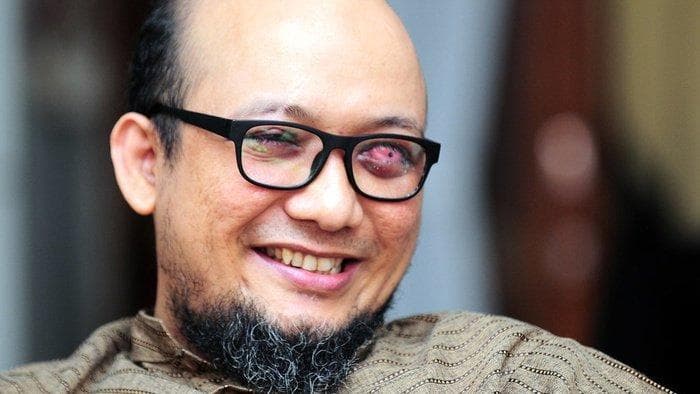 Mata kiri Novel Baswedan rusak permanen karena air keras. (Tirto/Arimacs WIlander)<br>