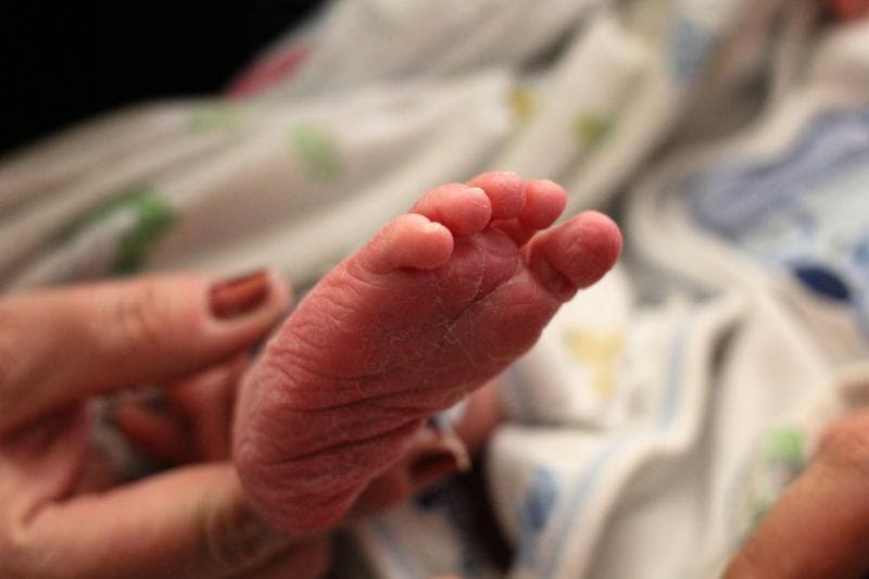 Bayi memiliki sistem imun yang rendah sehingga rentan terinfeksi virus corona. (Flickr/

Cory Denton)