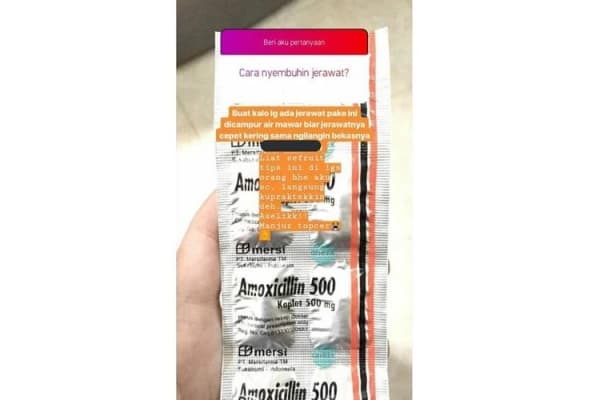Jangan Ngawur! Antibiotik Bukan Obat Jerawat, Begini Penjelasannya!