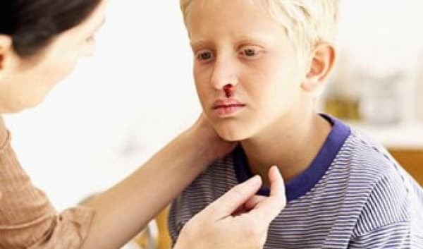 Sering Diabaikan, Kenali Gejala Leukimia Sejak Dini