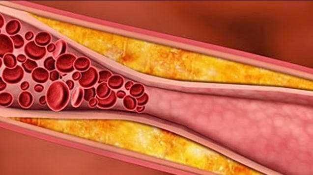 Flovanoid dalam mahkota dewa dapat menurunkan kolesterol jahat dalam darah. (Shutterstock)