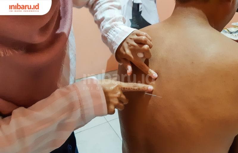 Terapi Akupunktur Semarang di Tengah Pusaran Obat Paten dan Masyarakat Modern