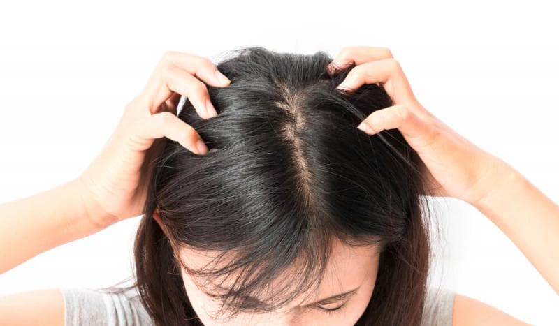 Kulit kepala bisa berketombe jika kamu punya kebiasaan tidur dengan rambut basah. (Tresemme)