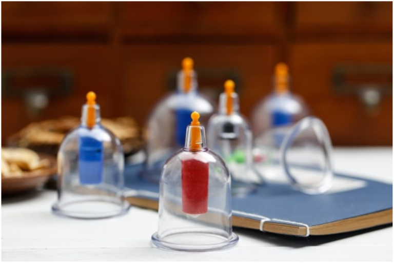 Terapi Bekam; Memahami Sejarah dan Manfaatnya