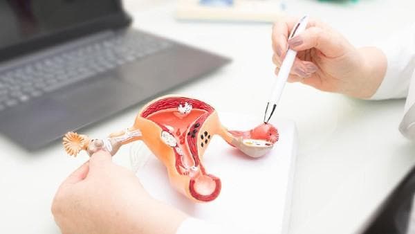 Tak Bisa Ditawar, Skrining Kanker Serviks Harus Sedini Mungkin