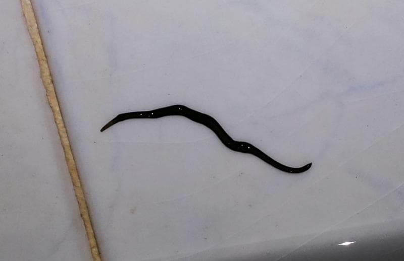 Tips Membasmi Cacing di Kamar Mandi