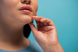 Cortisol Face Viral di Tiktok, Benarkah Stres Bikin Wajah 'Chubby' dan Bengkak?