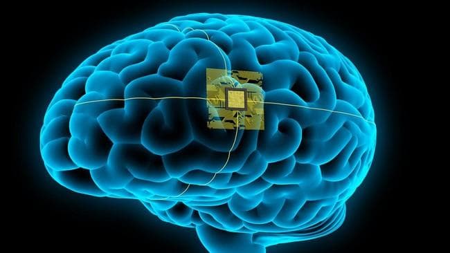 China Klaim Berhasil Komersialkan Chip Otak, Babak Baru Persaingan dengan Neuralin