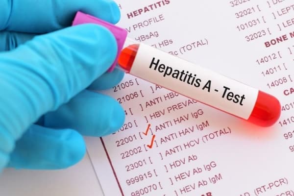 Pasien hepatitis A di Depok. (Kompas)